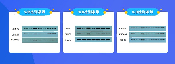 Western Blot检测  